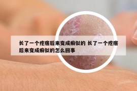 長了一個疙瘩后來變成癬似的 長了一個疙瘩后來變成癬似的怎么回事