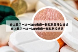 身上起了一塊一塊的像癬一樣紅色是什么癥狀 身上起了一塊一塊的像癬一樣紅色沒感覺