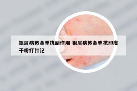 銀屑病蘇金單抗副作用 銀屑病蘇金單抗印度干粉打針記