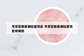 尋常型銀屑病檢查項(xiàng)目 尋常型銀屑病檢查項(xiàng)目有哪些