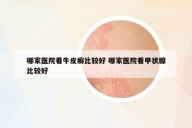 哪家醫(yī)院看牛皮癬比較好 哪家醫(yī)院看甲狀腺比較好