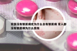 家族沒(méi)有銀屑病史為什么會(huì)有銀屑病 家人都沒(méi)有銀屑病為什么我有