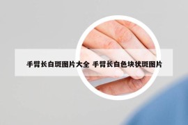 手臂長(zhǎng)白斑圖片大全 手臂長(zhǎng)白色塊狀斑圖片