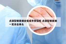 點滴型銀屑病會變成尋常型嗎 點滴型銀屑病一定會全身么