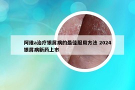 阿維a治療銀屑病的最佳服用方法 2024銀屑病新藥上市