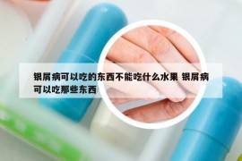 銀屑病可以吃的東西不能吃什么水果 銀屑病可以吃那些東西