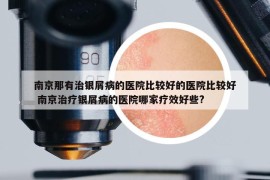 南京那有治銀屑病的醫(yī)院比較好的醫(yī)院比較好 南京治療銀屑病的醫(yī)院哪家療效好些?