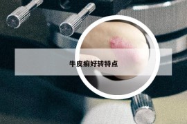 牛皮癬好轉(zhuǎn)特點(diǎn)
