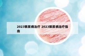 2023銀屑病治療 2023銀屑病治療指南