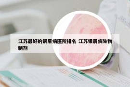 江蘇最好的銀屑病醫(yī)院排名 江蘇銀屑病生物制劑