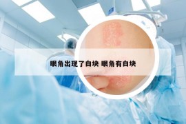 眼角出現(xiàn)了白塊 眼角有白塊