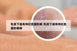 乳房下面有塊紅色圓形癬 乳房下面有塊紅色圓形癬癢