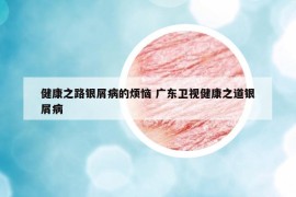 健康之路銀屑病的煩惱 廣東衛(wèi)視健康之道銀屑病