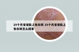 29個月寶寶臉上有白斑 29個月寶寶臉上有白斑怎么回事
