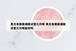 男方有銀屑病做試管幾代呢 男方有銀屑病做試管幾代呢能好嗎