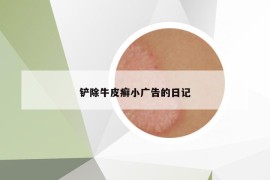 鏟除牛皮癬小廣告的日記