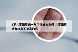 8歲兒童銀屑病一年了還好治愈嗎 兒童銀屑病有終身不復(fù)發(fā)的嗎