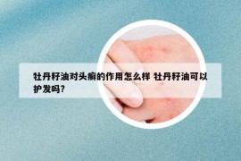 牡丹籽油對頭癬的作用怎么樣 牡丹籽油可以護發(fā)嗎?