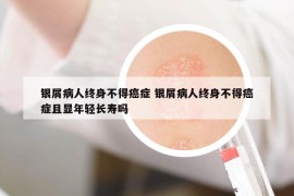 銀屑病人終身不得癌癥 銀屑病人終身不得癌癥且顯年輕長壽嗎
