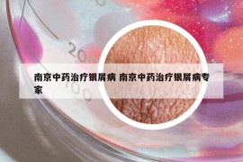南京中藥治療銀屑病 南京中藥治療銀屑病專家