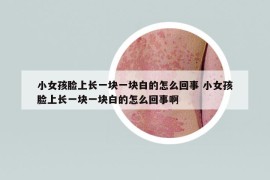 小女孩臉上長(zhǎng)一塊一塊白的怎么回事 小女孩臉上長(zhǎng)一塊一塊白的怎么回事啊