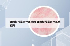 強的松片是治什么病的 強的松片是治什么病的藥