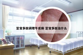 至寶多肽調(diào)理牛皮癬 至寶多肽治什么