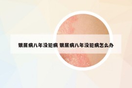 銀屑病八年沒犯病 銀屑病八年沒犯病怎么辦