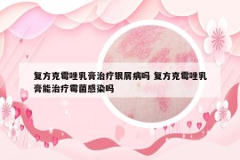 復方克霉唑乳膏治療銀屑病嗎 復方克霉唑乳膏能治療霉菌感染嗎
