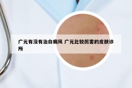 廣元有沒有治白癜風 廣元比較厲害的皮膚診所