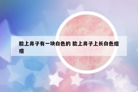 臉上鼻子有一塊白色的 臉上鼻子上長白色痘痘