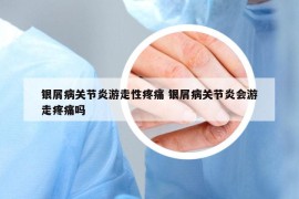銀屑病關(guān)節(jié)炎游走性疼痛 銀屑病關(guān)節(jié)炎會(huì)游走疼痛嗎