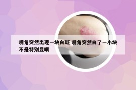嘴角突然出現(xiàn)一塊白斑 嘴角突然白了一小塊不是特別顯眼