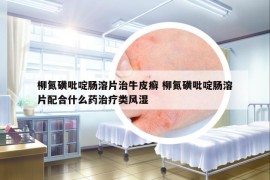柳氮磺吡啶腸溶片治牛皮癬 柳氮磺吡啶腸溶片配合什么藥治療類風(fēng)濕