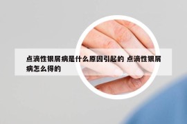 點(diǎn)滴性銀屑病是什么原因引起的 點(diǎn)滴性銀屑病怎么得的
