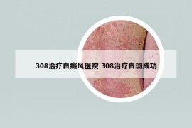 308治療白癜風(fēng)醫(yī)院 308治療白斑成功