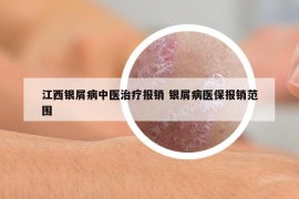 江西銀屑病中醫(yī)治療報(bào)銷 銀屑病醫(yī)保報(bào)銷范圍