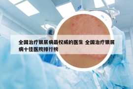 全國治療銀屑病最權(quán)威的醫(yī)生 全國治療銀屑病十佳醫(yī)院排行榜