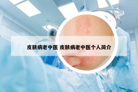 皮膚病老中醫(yī) 皮膚病老中醫(yī)個(gè)人簡介
