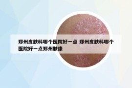 鄭州皮膚科哪個(gè)醫(yī)院好一點(diǎn) 鄭州皮膚科哪個(gè)醫(yī)院好一點(diǎn)鄭州膚康