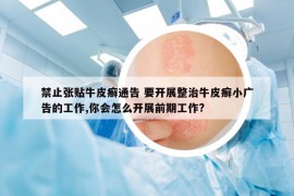禁止張貼牛皮癬通告 要開展整治牛皮癬小廣告的工作,你會(huì)怎么開展前期工作?