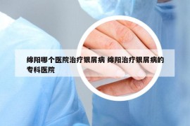 綿陽哪個醫(yī)院治療銀屑病 綿陽治療銀屑病的?？漆t(yī)院