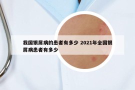 我國(guó)銀屑病的患者有多少 2021年全國(guó)銀屑病患者有多少