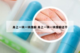 身上一塊一塊像癬 身上一塊一塊像癬還干