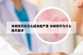體癬擦藥后怎么越來越嚴(yán)重 體癬擦藥為什么越長越多