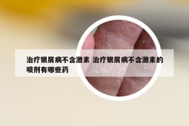 治療銀屑病不含激素 治療銀屑病不含激素的噴劑有哪些藥