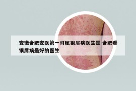 安徽合肥安醫(yī)第一附屬銀屑病醫(yī)生是 合肥看銀屑病最好的醫(yī)生