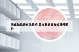 黃皮膚軟膏有效果嗎 黃皮膚軟膏有效果嗎圖片