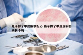 兒子得了牛皮癬很擔(dān)心 孩子得了牛皮皮癬影響長個嗎