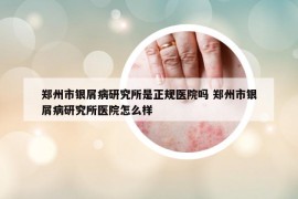 鄭州市銀屑病研究所是正規(guī)醫(yī)院嗎 鄭州市銀屑病研究所醫(yī)院怎么樣
